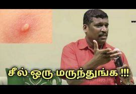சீல் பிடித்தால் நல்லதுங்க | Healer baskar