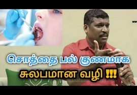 சொத்தைப்பல், பல்வலி குணமாக இப்படி செய்யுங்க | Healer baskar speech on Tooth decay