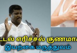 உடல் எரிச்சல் குணமாக இயற்கை வைத்தியம் | Healer Baskar speech on remedy for Udal erichal