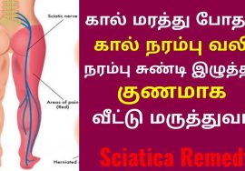 சியாட்டிகா என்னும் கால் நரம்பு வலி,கால் மரத்து போதல் குணமாக வீட்டு வைத்தியம் | Sciatica home remedy