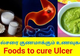 வயிற்றுப்புண்ணை குணமாக்கும் உணவுகள் | Foods to cure Ulcer | Home remedy for ulcer